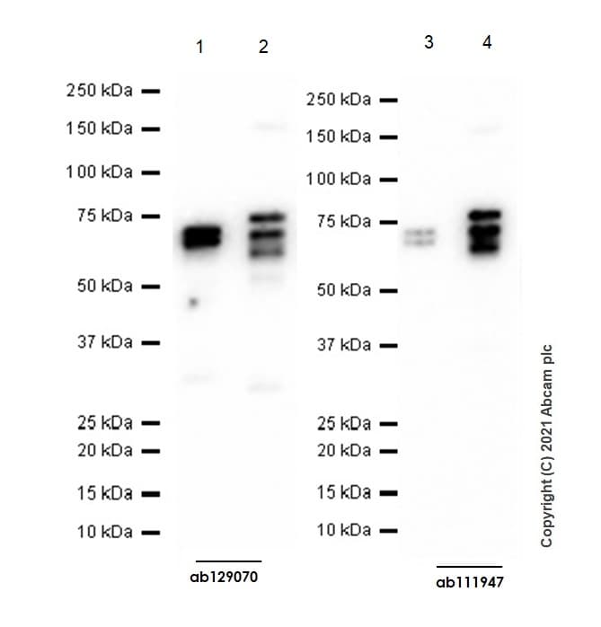 Anti-PTP1B + TCPTP antibody [EPR6712](AB129070)