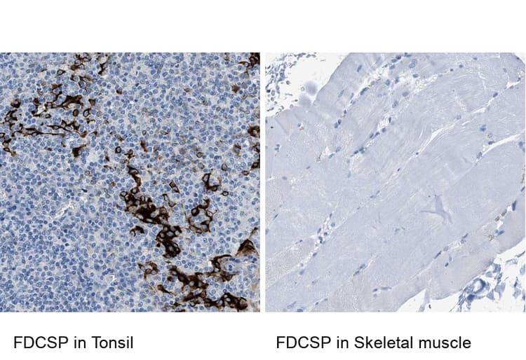 Fdcsp Antibody Ab121420  Immunohistochemistry Formalin Pfa Fixed Paraffin Embedded Sections Img171528