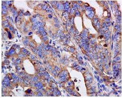 Aspartate Beta Hydroxylase Antibody Epr10351 Bsa And Azide Free Ab249694  Immunohistochemistry Formalin Pfa Fixed Paraffin Embedded Sections Img99905