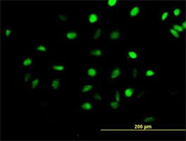 Cenph Antibody Ab88593  Immunocytochemistry Immunofluorescence Img113328