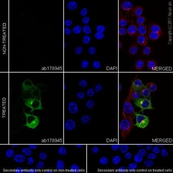 Anti-iNOS antibody [EPR16635](AB178945)