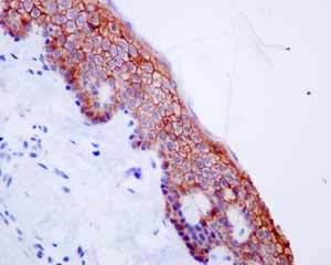 Anti-Syndecan-1 antibody [EPR6454](AB128936)