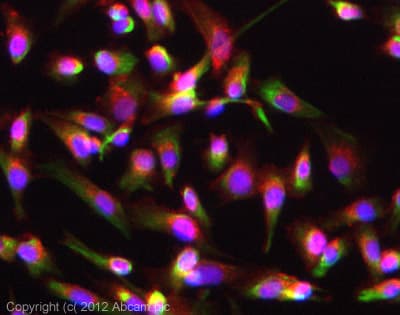 Anti-Nestin antibody [SP103](AB105389)