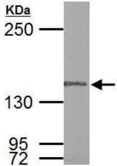 Polg Antibody Ab97661  Western Blot Img85249
