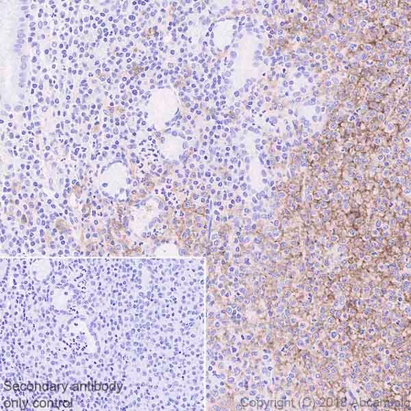 Anti-FCRL4 antibody [EPR21961](ab239076)