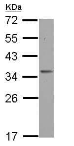 Anti-OTUD6B antibody(AB127714)