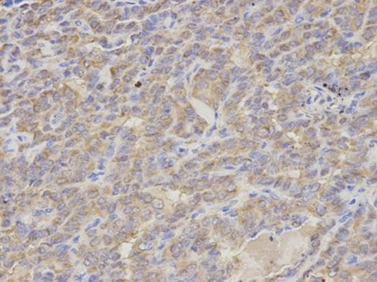S100a12 Cgrp Antibody Ab196740  Immunohistochemistry Formalin Pfa Fixed Paraffin Embedded Sections Img127365