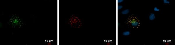 Anti-mCherry antibody(AB183628)