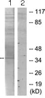 Anti-TMEPAI antibody(AB128006)
