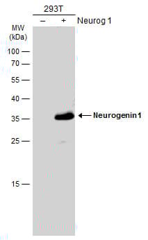 Anti-Neurogenin 1/NEUROG1 antibody(AB272926)
