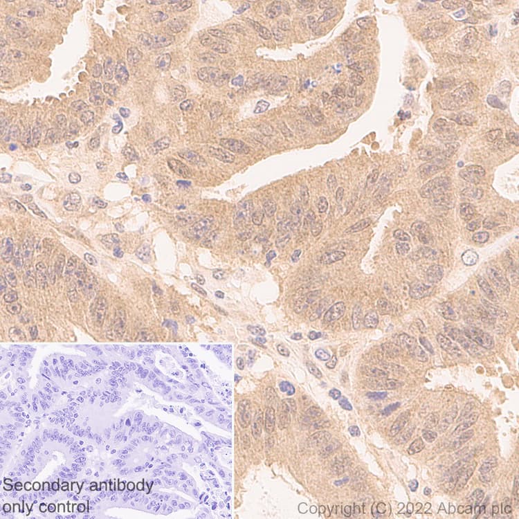 Smad2 Smad3 Antibody 18 Smad2 3 Bsa And Azide Free Ab305326  Immunohistochemistry Img406206