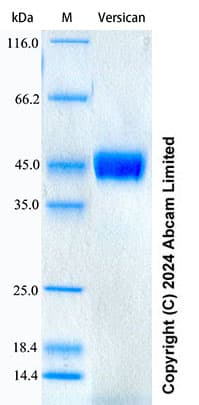 Ab322748  Sds Page Img439247