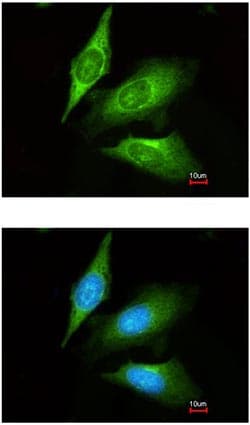Tmed4 Antibody Ab153814  Immunocytochemistry Immunofluorescence Img85329