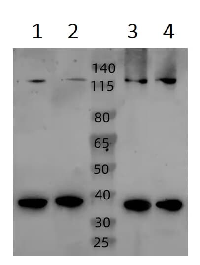 Ac3 Antibody C Terminal Ab199157  Western Blot Img427713