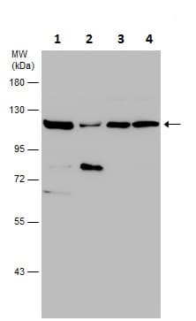 Anti-Hexokinase II antibody(AB227198)