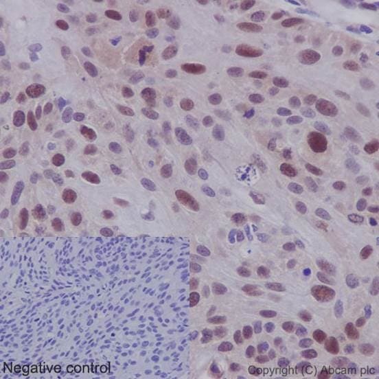 Anti-Cdk2 antibody [E304](AB32147)