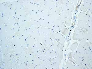 Anti-Trefoil Factor 3 antibody [EPR3974](AB108599)
