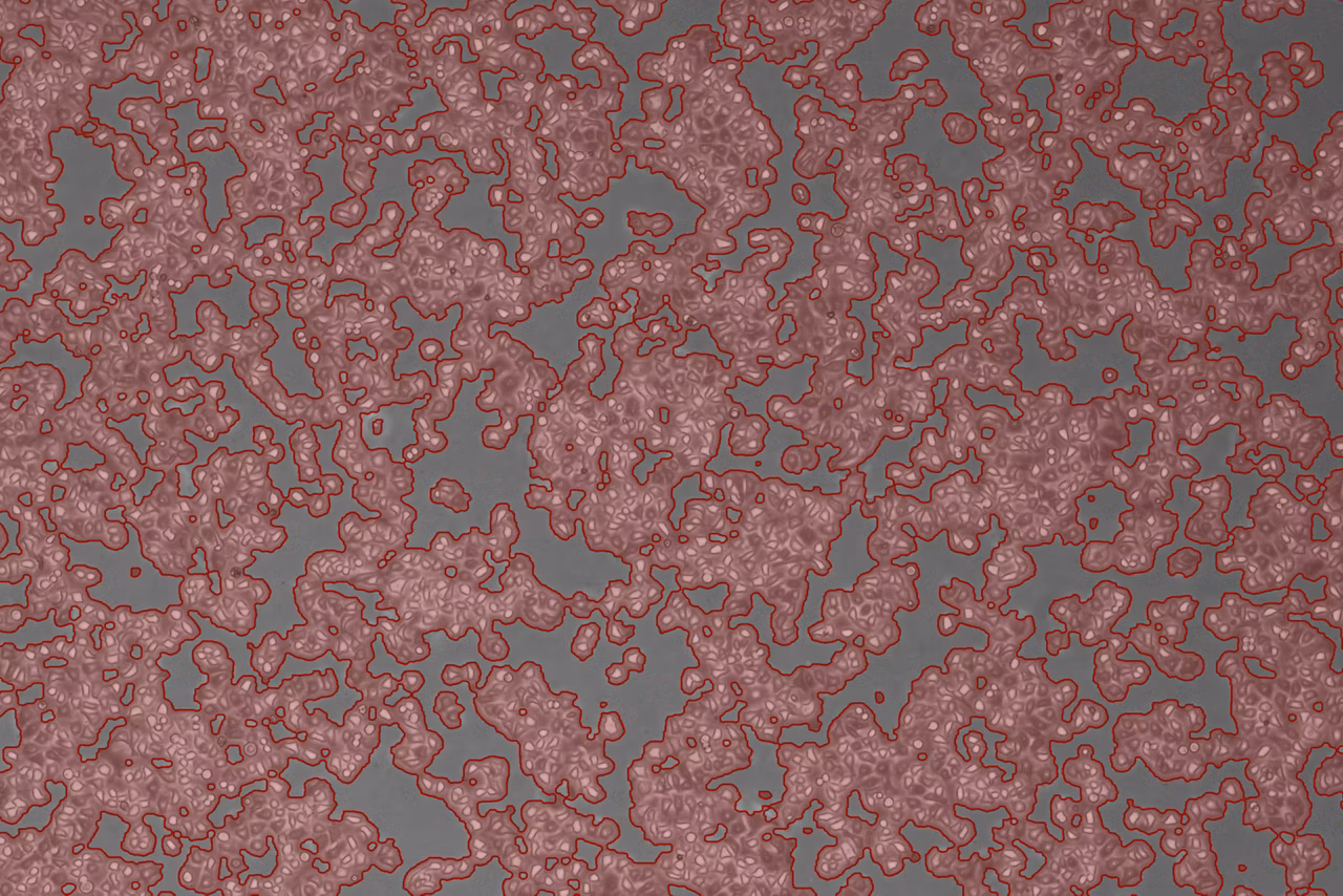 Hela4 Cells Right Kid21764933