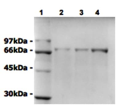 Recombinant Human Progerin protein(AB93918)
