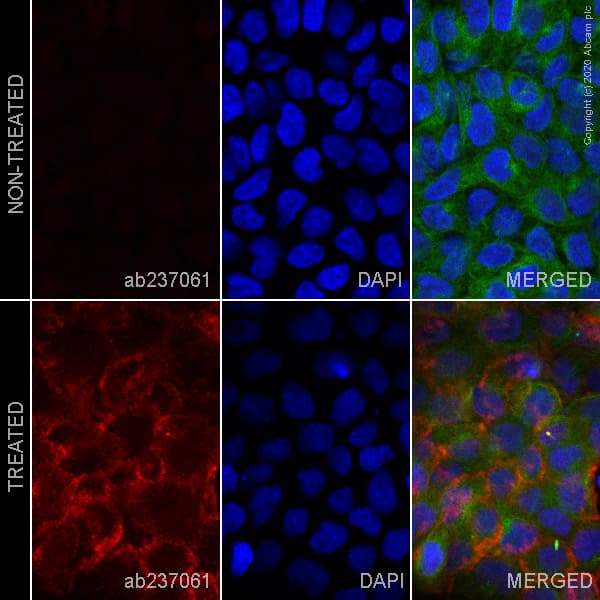 Alexa Fluor 647 Erbb2 Her2 Phospho Y877 Antibody Ep2324y Ab237061  Immunocytochemistry Immunofluorescence Img91145