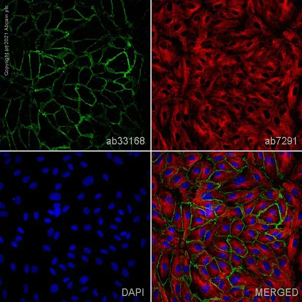 Anti-VE Cadherin antibody - Intercellular Junction Marker(AB33168)