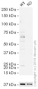 HRP Anti-GBA antibody [EPR5142](AB200856)