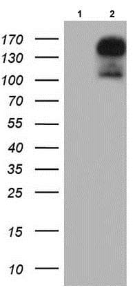 Gli2 Antibody Oti1f9 Ab187386  Western Blot Img120830