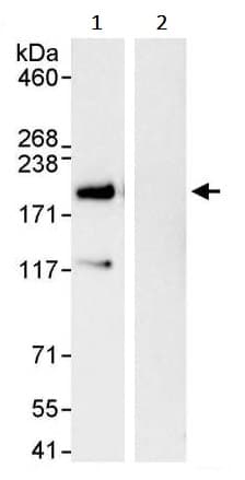 Vprbp Antibody Ab245483  Immunoprecipitation Img68851
