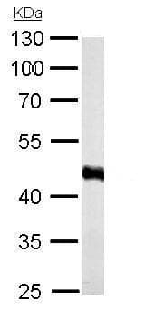 Anti-ADK antibody(AB227087)