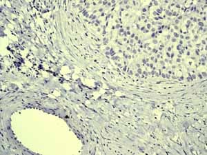 Anti-Cytokeratin 20 antibody [EPR1622Y] - BSA and Azide free(AB219589)