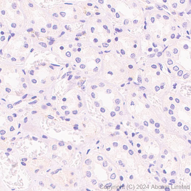 Anti-MASH1/Achaete-scute homolog 1 antibody [EPR19840](AB211327)