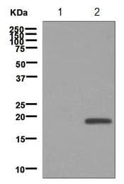 Anti-Alpha-synuclein (phospho Y125) antibody [EPR2179(2)](AB124955)