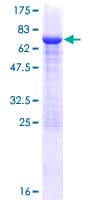 Recombinant Human Pellino 2 protein(AB163508)