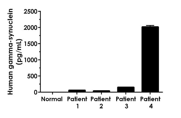Human gamma-synuclein ELISA Kit(ab224884)