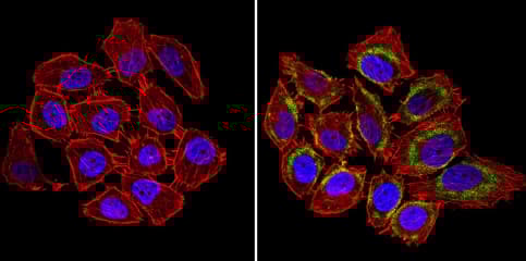 Anti-nNOS (neuronal) antibody(AB5586)