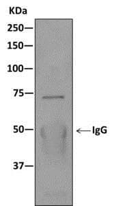 Kbtbd11 Antibody Epr100562b Bsa And Azide Free Ab249501  Immunoprecipitation Img59614