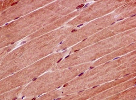 Anti-PHD finger protein 1/PHF1 antibody [EPR14222](AB184951)