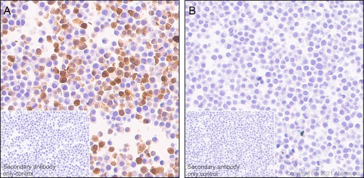 Anti-IL-1 beta antibody [RM1009](AB283818)