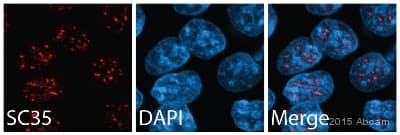 Anti-SC35 antibody [SC-35] - Nuclear Speckle Marker(AB11826)