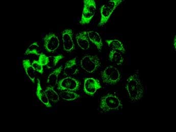 Anti-PFKM antibody [EPR10734(B)] - BSA and Azide free(AB232495)