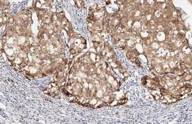 Lass2 Antibody Hl1717 Ab308189  Immunohistochemistry Paraffin Embedded Sections Img407278