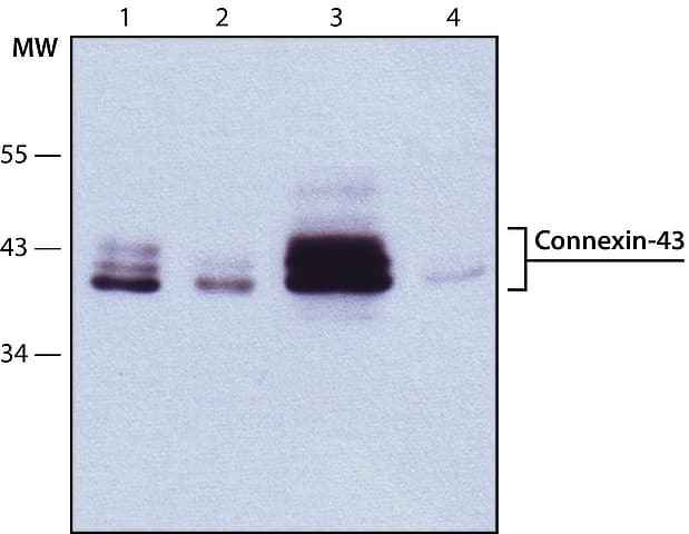 Anti-Connexin 43 / GJA1 antibody - Intercellular Junction Marker(AB11370)