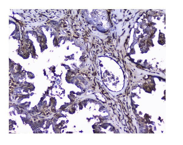 Galectin 1 Antibody Ab112525  Immunohistochemistry Formalin Pfa Fixed Paraffin Embedded Sections Img22539