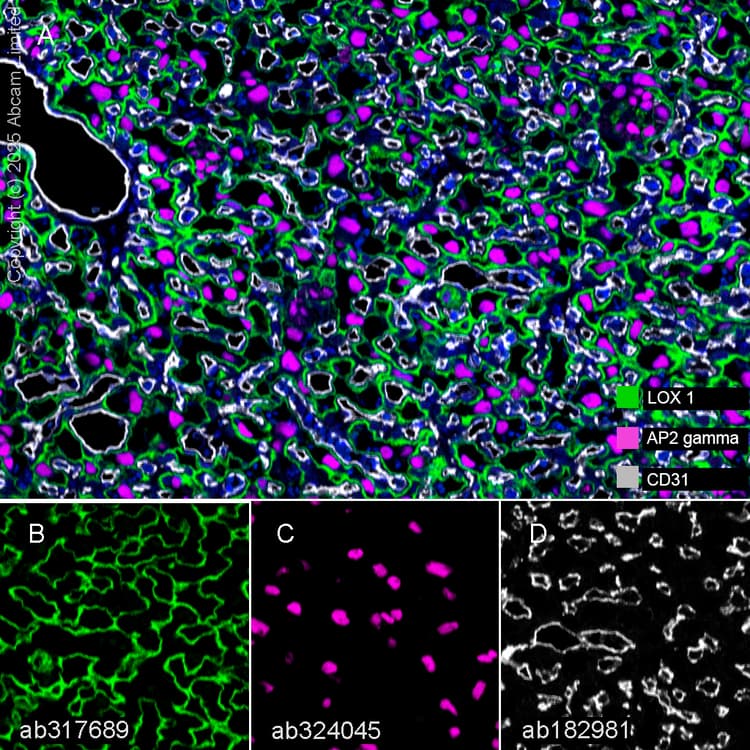 Lox 1 Antibody Epr27871 67 Bsa And Azide Free Ab317690  Multiplex Immunohistochemistry Img450299