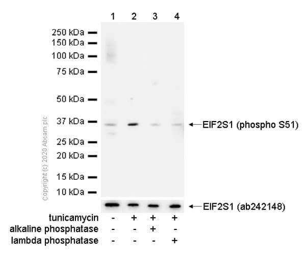 Anti-EIF2S1 (phospho S51) antibody [E90](AB32157)