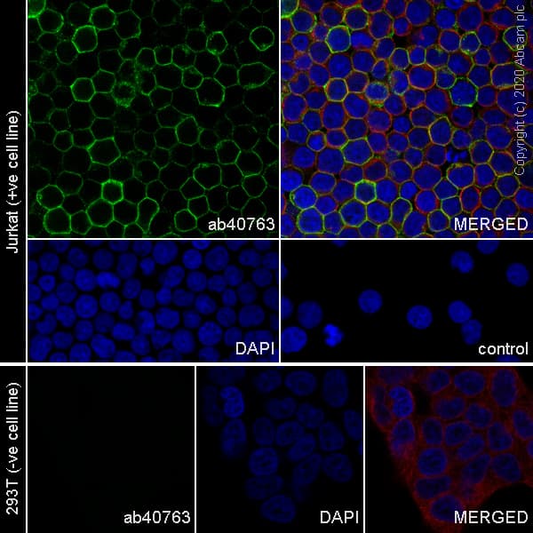Anti-CD45 antibody [EP322Y](AB40763)