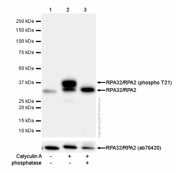 Anti-RPA32/RPA2 (phospho T21) antibody [EPR2846(2)](AB109394)