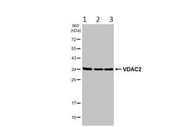 Anti-VDAC2 antibody - C-terminal(AB155803)