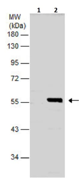 Rip3 Antibody Ab246523  Western Blot Img145701