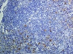 Il 2 Receptor Alpha Antibody Epr6452 Ab128955  Immunohistochemistry Formalin Pfa Fixed Paraffin Embedded Sections Img89597